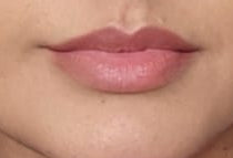 Mini Lip filler